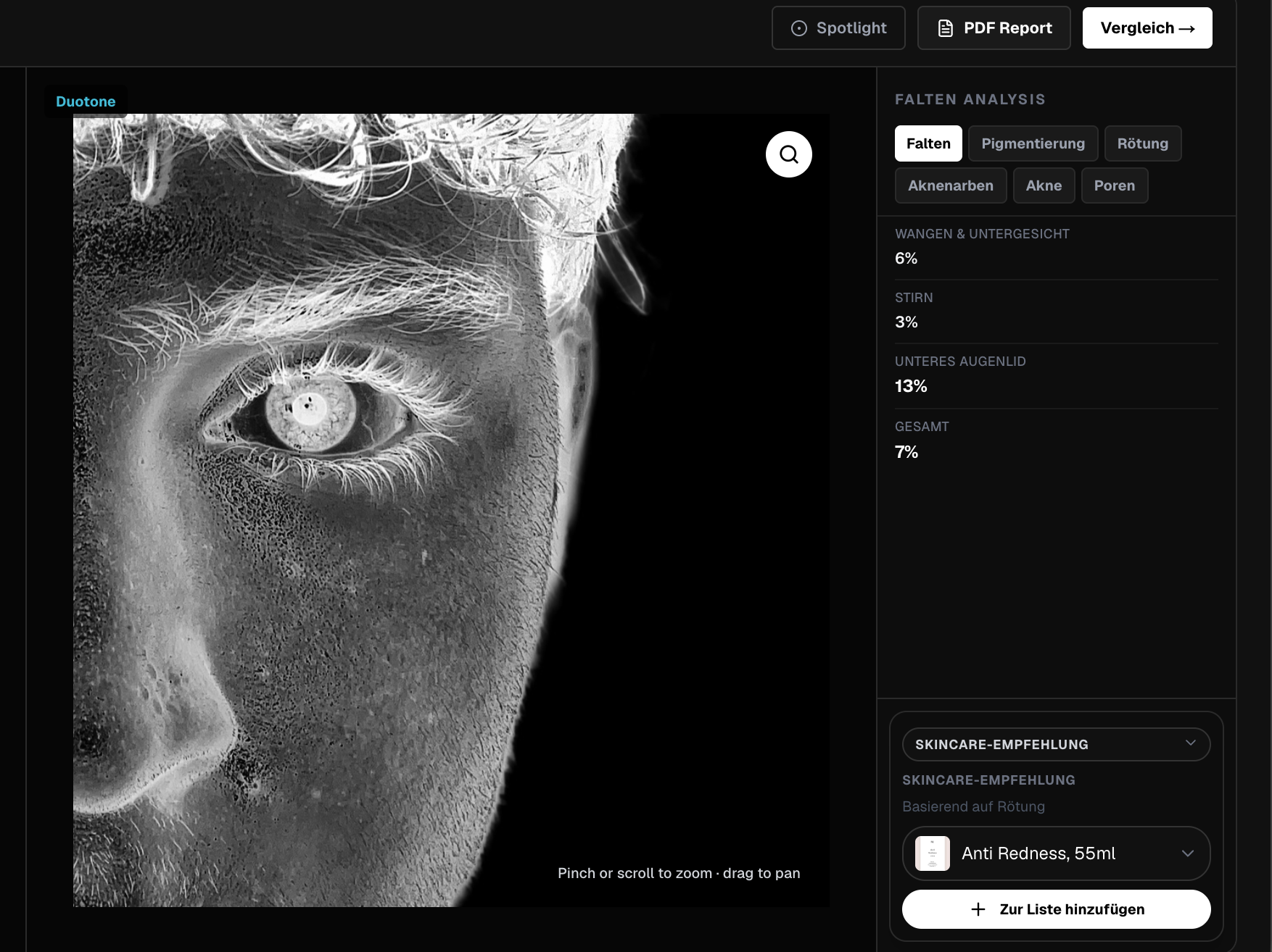 Yasu Labs — wrinkle analysis zoom view